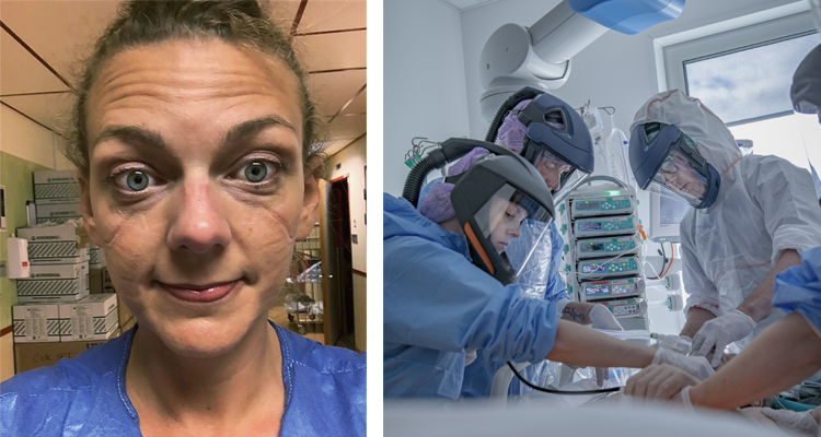 Två bilder. Den ena visar sköterskans ansikte. Hon har märken efter skydden som hon måste ha på sig. Den högra bilden visar personal på ett sjukhus som hjälper en patient. Alla har blå skyddskläder och munskydd på sig.
