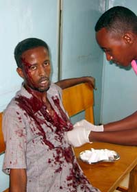 En skadad man får vård på sjukjus i Somalias  huvudstad Mogadishu. Foto: Mohamed Sheikh Nor/AP/Scanpix