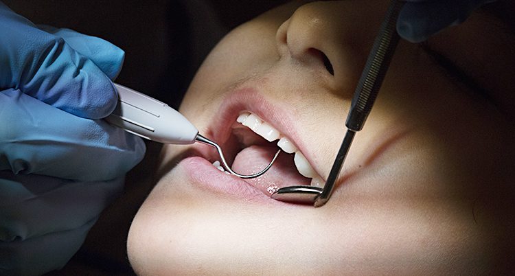 Ett barns mun upplyst av tandläkarlampan. En plastbeklädd hand använder två instrument i barnets mun.