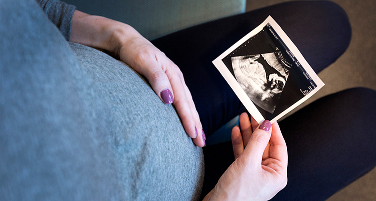 En gravid kvinna håller i en bild på bebisen i magen.