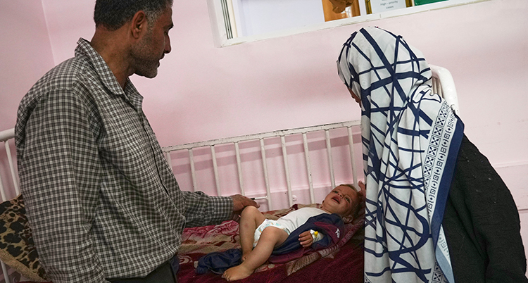 Mideast Wars Malnourished Children